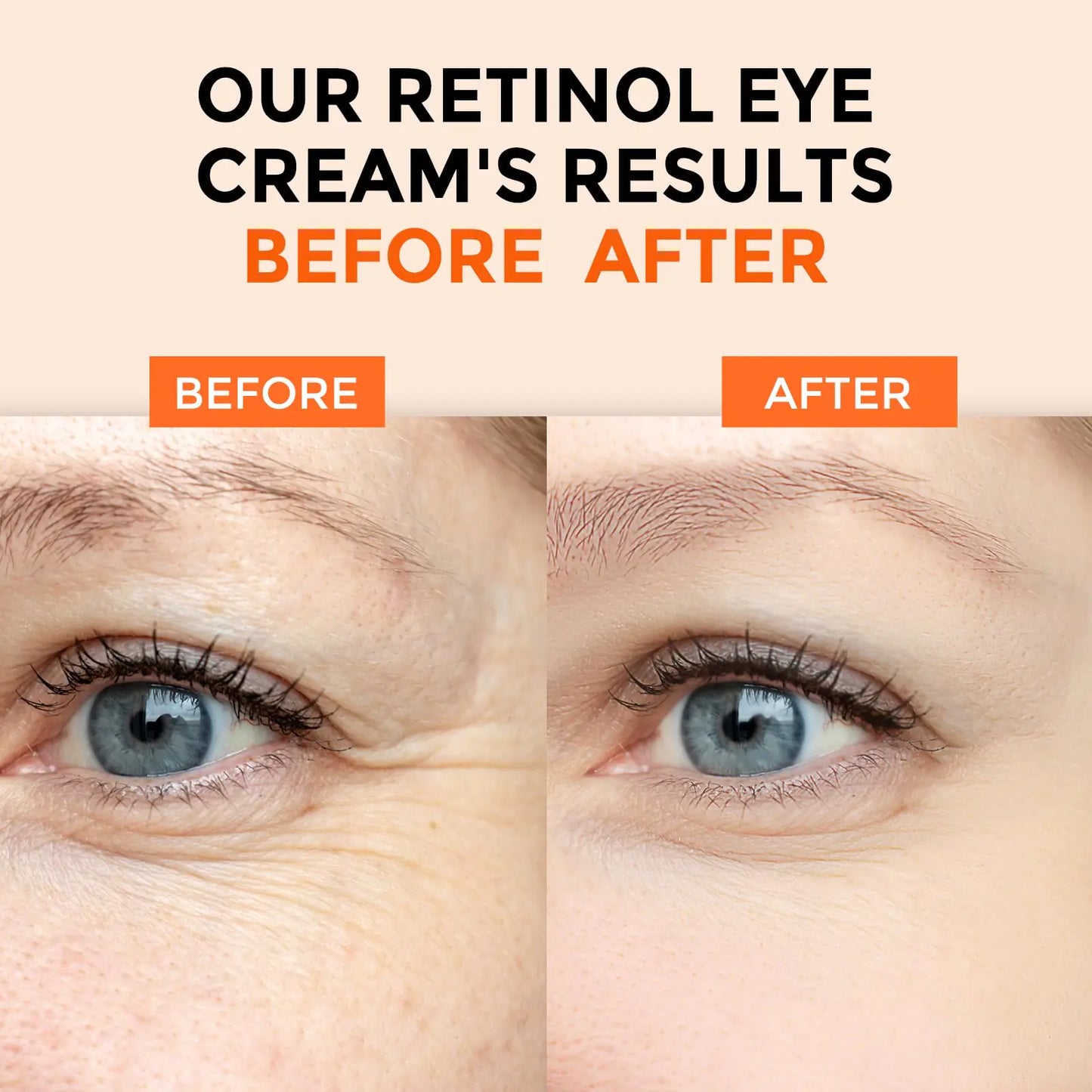 Retinol Eye Cream for Dark Circles and Puffiness, Anti Aging Under Eye Cream with Hyaluronic Acid, Retinol & Collagen to Fight Fine Lines, Wrinkles & Dark Spots Retinol Eye Cream(0.7oz)